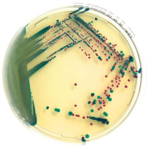 Изображение —ХРОМОГЕННАЯ СЕЛЕКТИВНАЯ СРЕДА ДЛЯ ВЫДЕЛЕНИЯ STAPHYLOCOCCUS AUREUS ХРОМОГЕННАЯ СЕЛЕКТИВНАЯ СРЕДА ДЛЯ ВЫДЕЛЕНИЯ STAPHYLOCOCCUS AUREUS