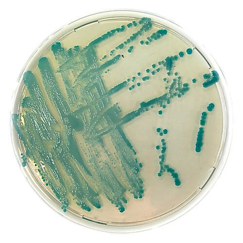Изображение — ХРОМОГЕННАЯ СЕЛЕКТИВНАЯ СРЕДА ДЛЯ ВЫДЕЛЕНИЯ STAPHYLOCOCCUS AUREUS ХРОМОГЕННАЯ СЕЛЕКТИВНАЯ СРЕДА ДЛЯ ВЫДЕЛЕНИЯ STAPHYLOCOCCUS AUREUS