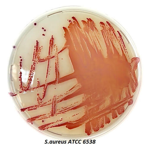 Изображение — ХРОМОГЕННАЯ СЕЛЕКТИВНАЯ СРЕДА ДЛЯ ВЫДЕЛЕНИЯ STAPHYLOCOCCUS AUREUS ХРОМОГЕННАЯ СЕЛЕКТИВНАЯ СРЕДА ДЛЯ ВЫДЕЛЕНИЯ STAPHYLOCOCCUS AUREUS